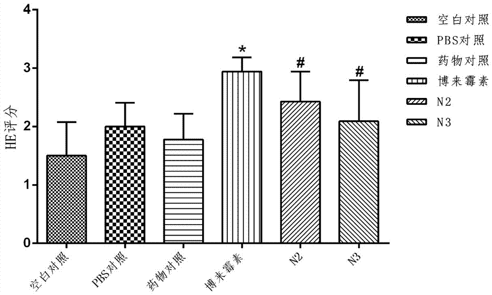 Application of polypeptide and polypeptide derivative in prevention and treatment of fibrotic diseases