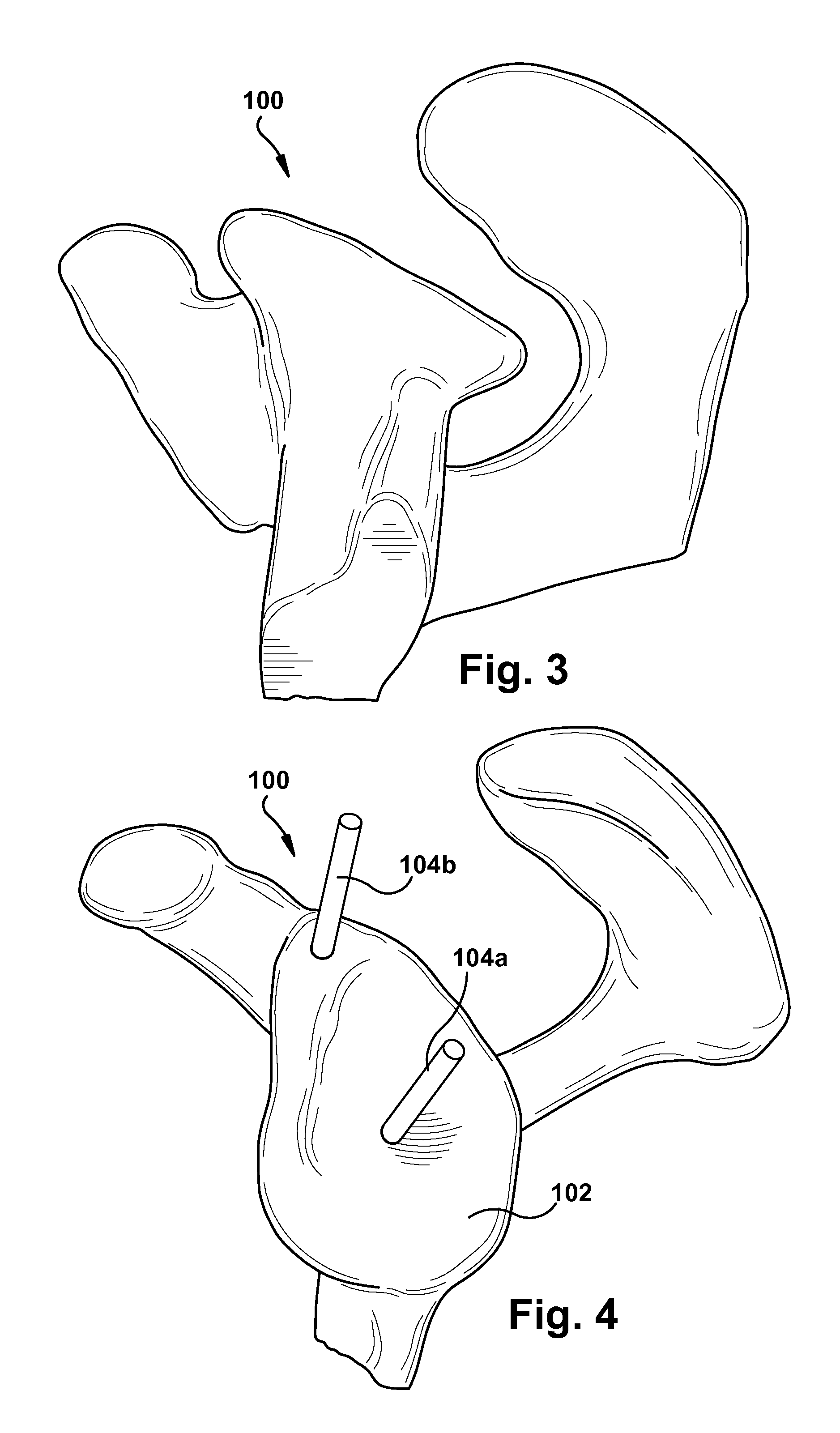 Method and system for producing at least one patient-specific surgical aid