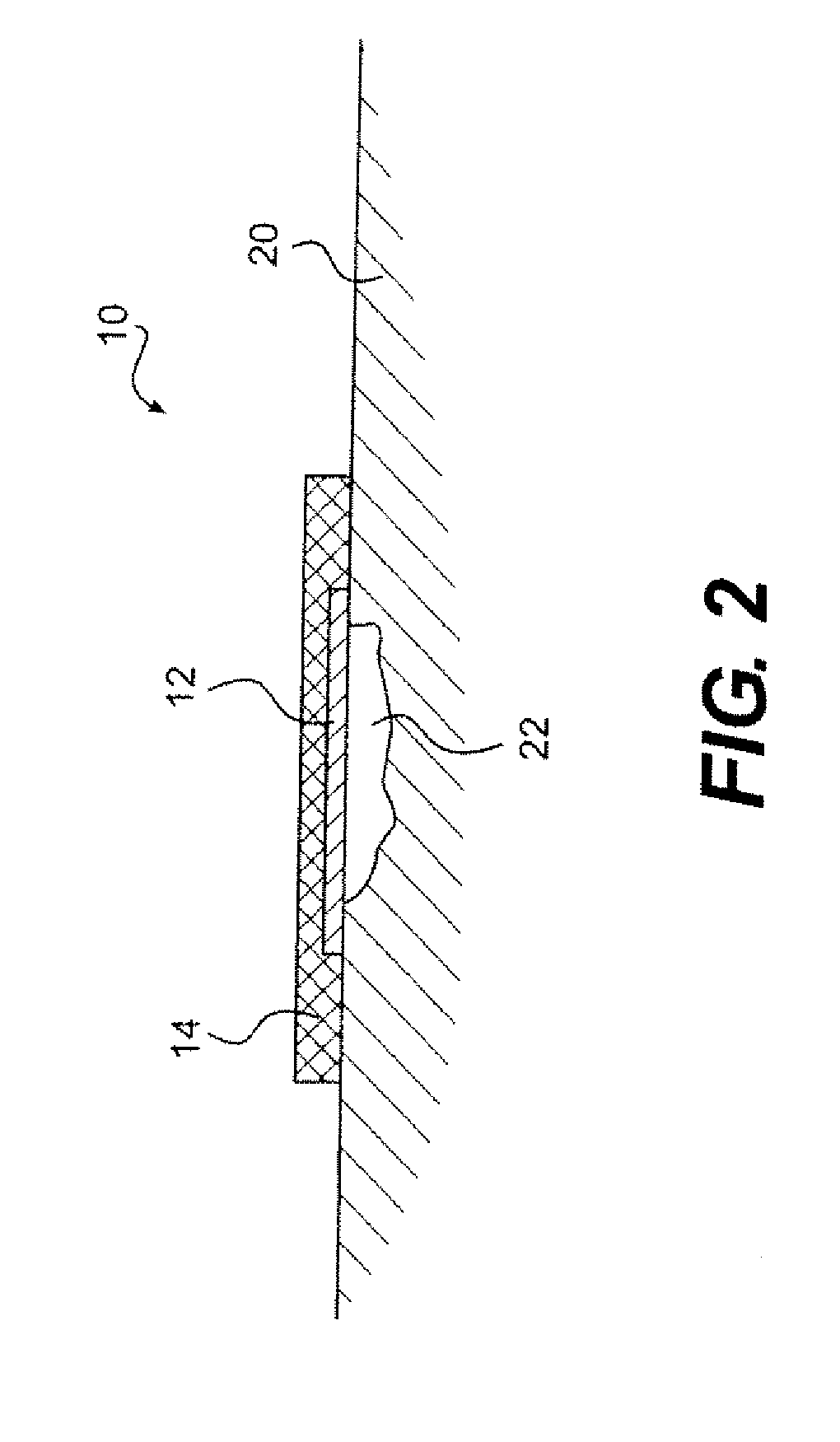 Device and method for healing wounds