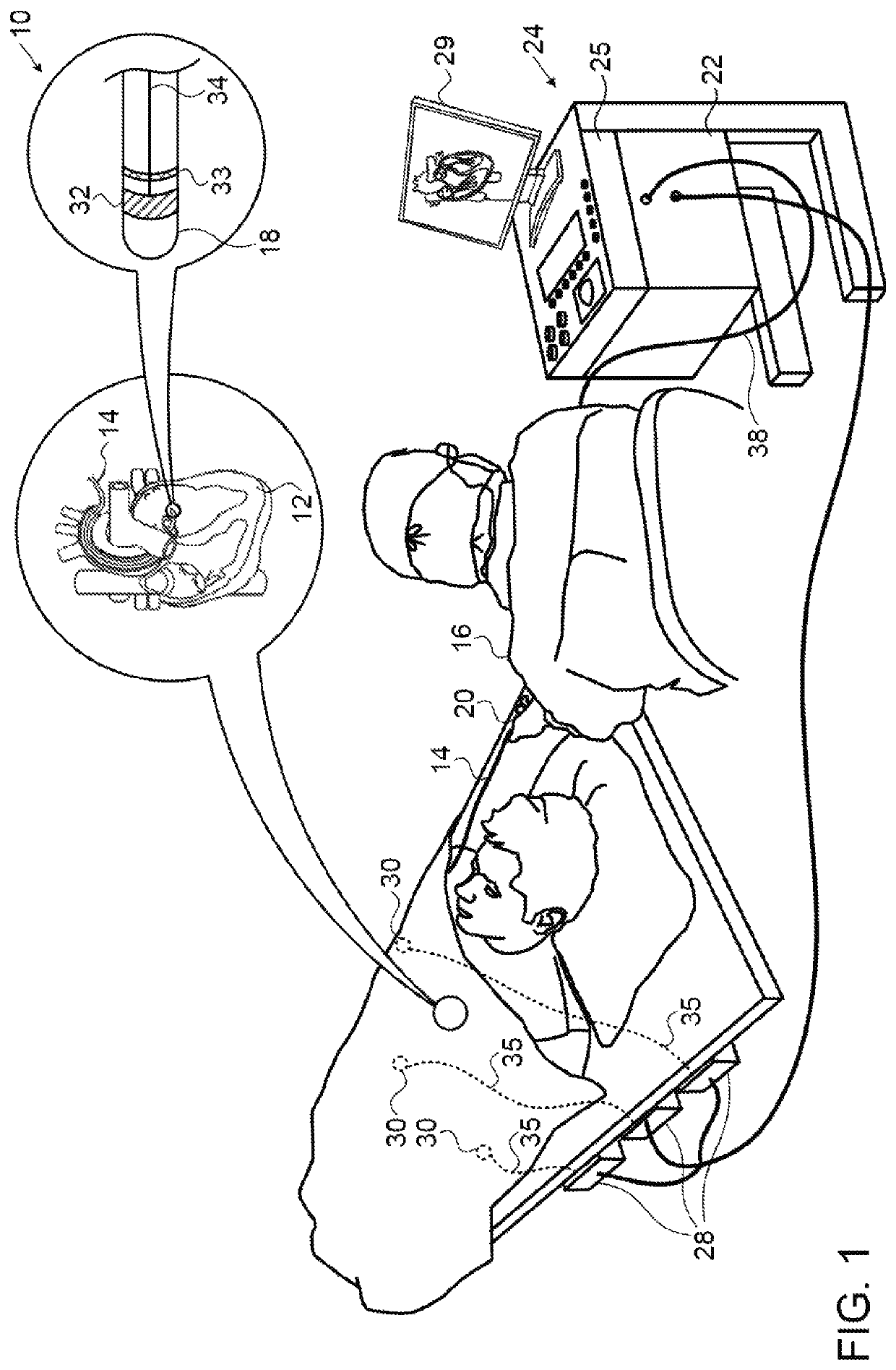 Ablation power supply