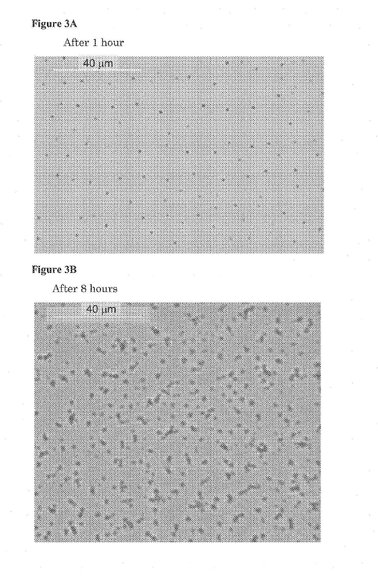 Oral gastroretentive formulations and uses thereof