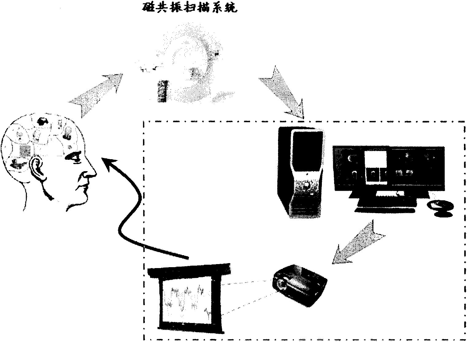 Nervous feedback system based on real-time functional magnetic resonance signal