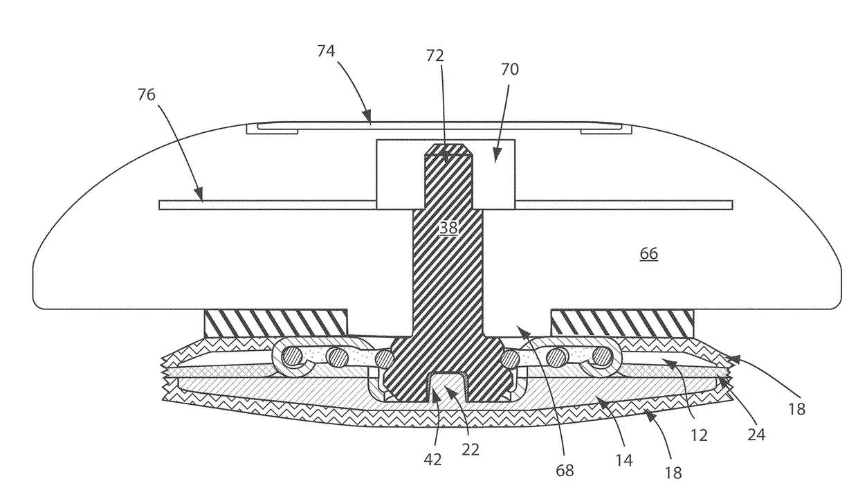 Electrode assembly