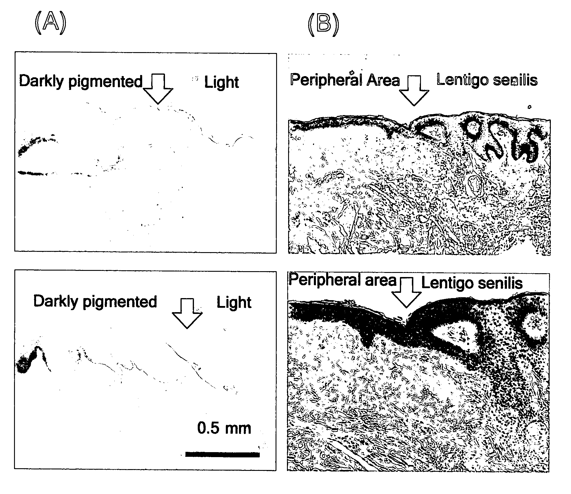 Animal model for pigment spots