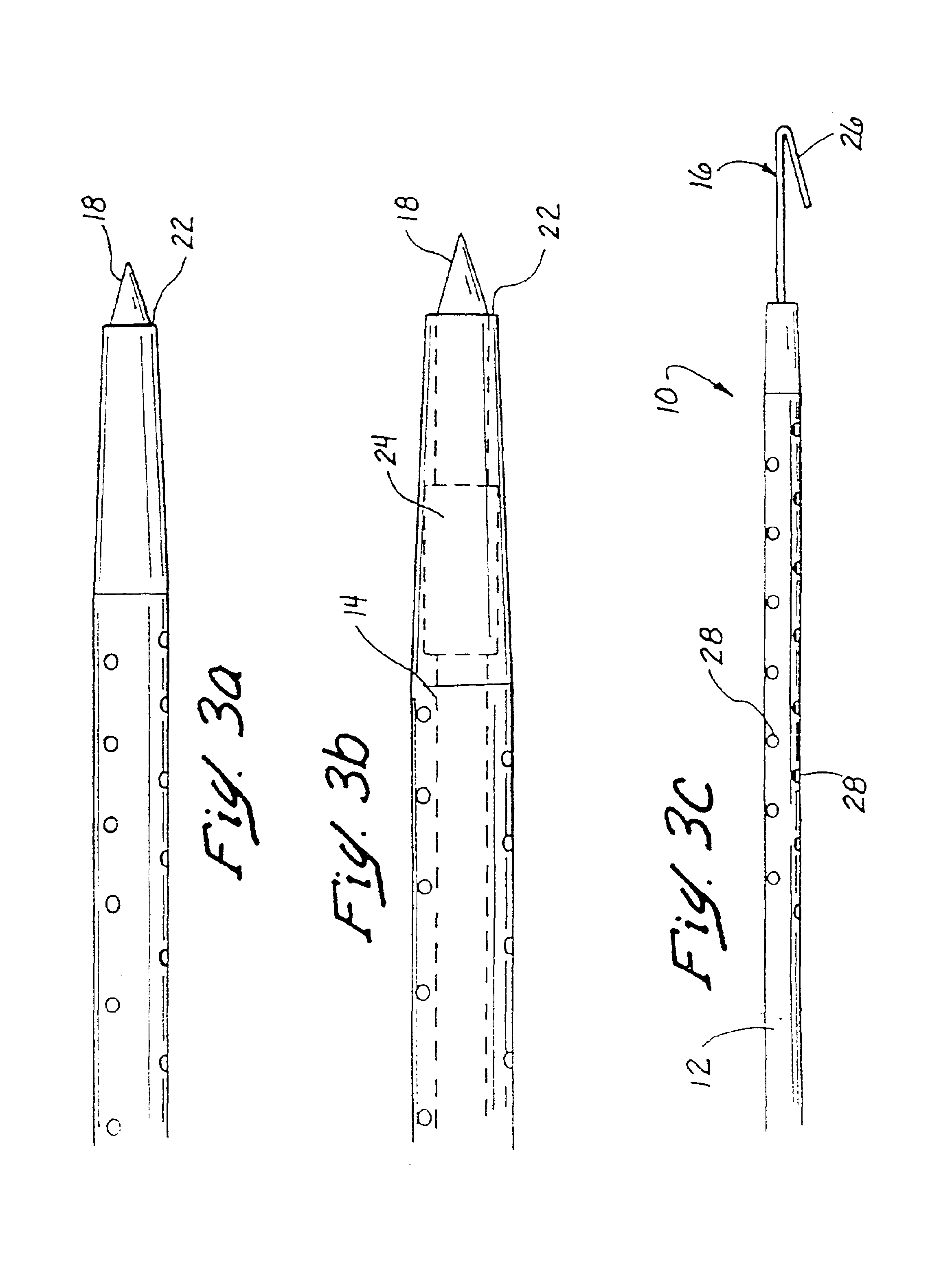 Methods and apparatus for securing medical instruments to desired locations in a patient's body