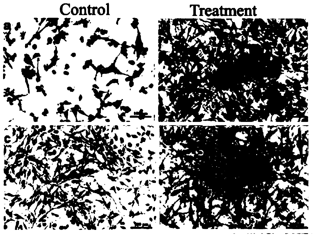 Method for inhibiting growth and metastasis of solid tumor cells and special pharmaceutical composition