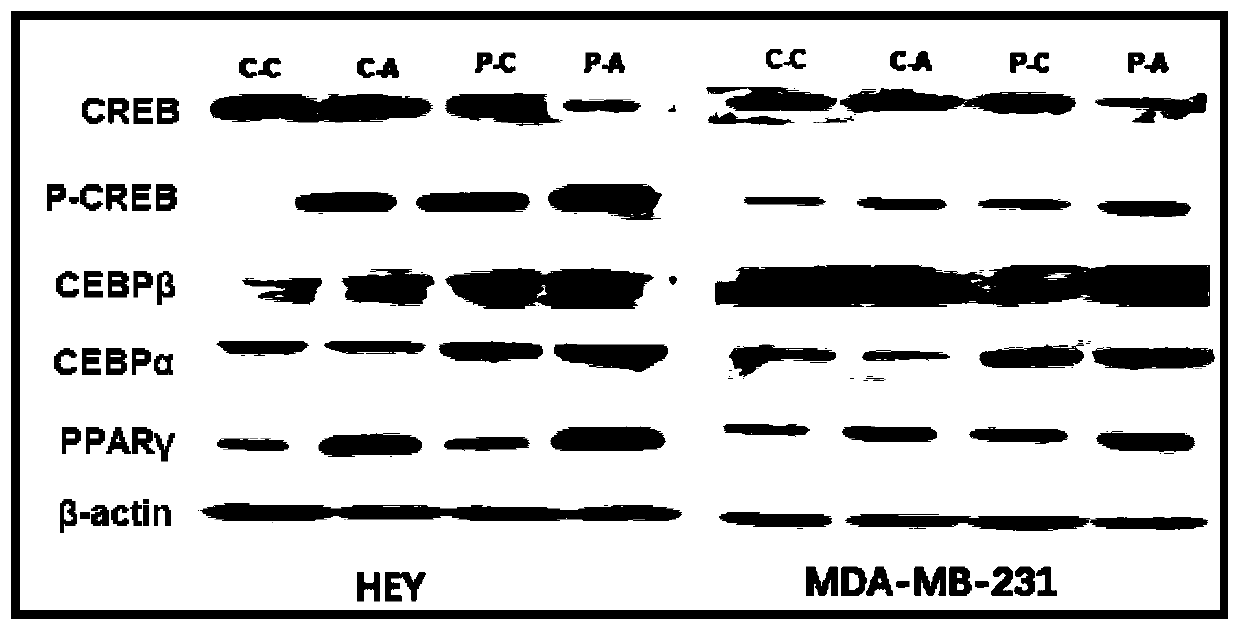 Method for inhibiting growth and metastasis of solid tumor cells and special pharmaceutical composition