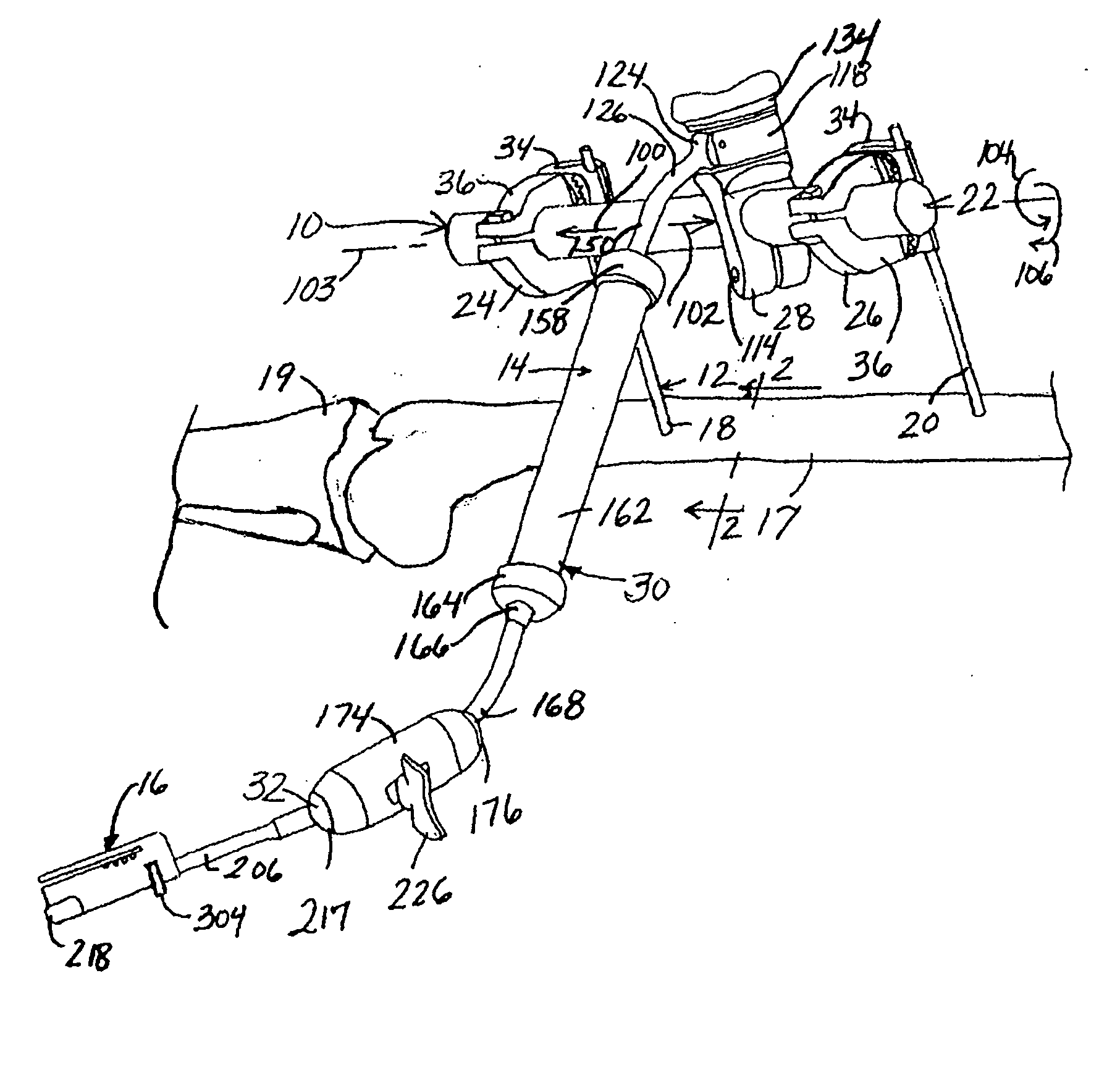 Method of resecting bone