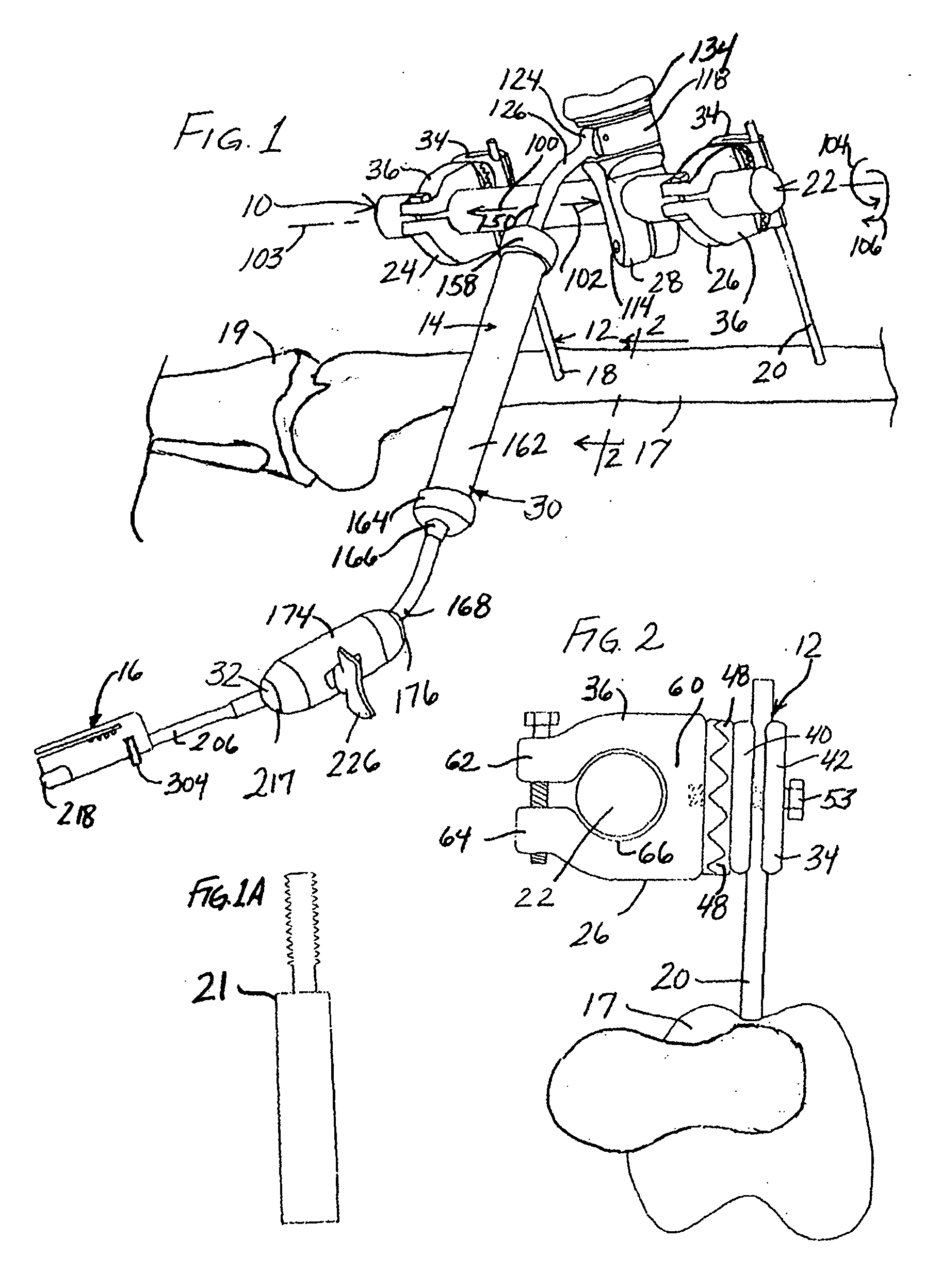 Method of resecting bone