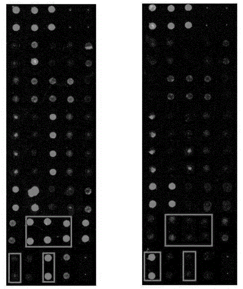 Antibody chip kit for detecting early gastric cancer