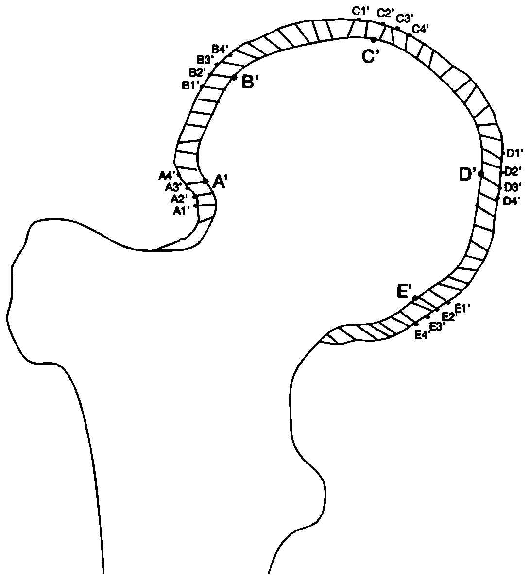 Bone surface registration method for covered cartilage