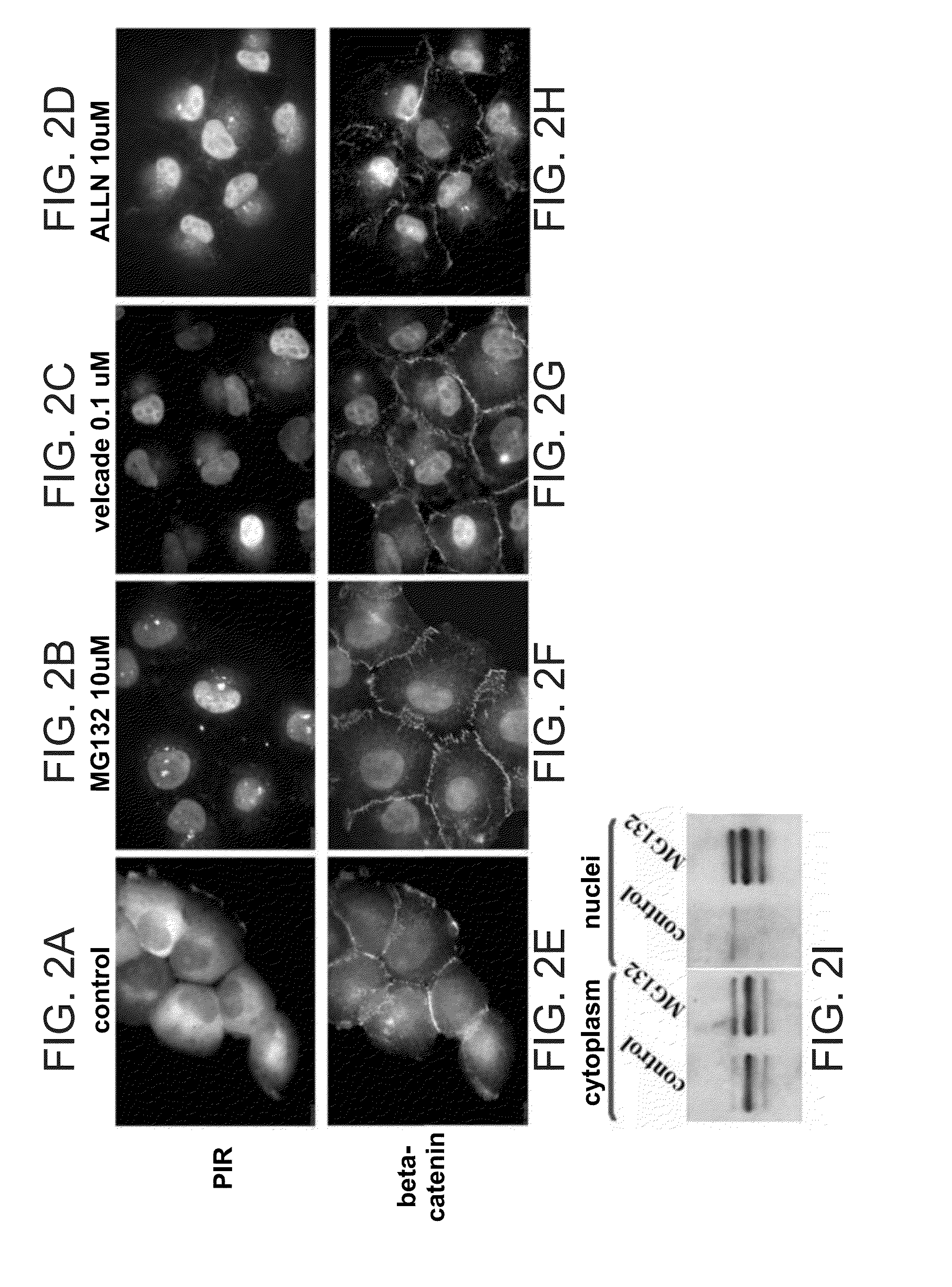 Proteasome inhibitors and uses thereof