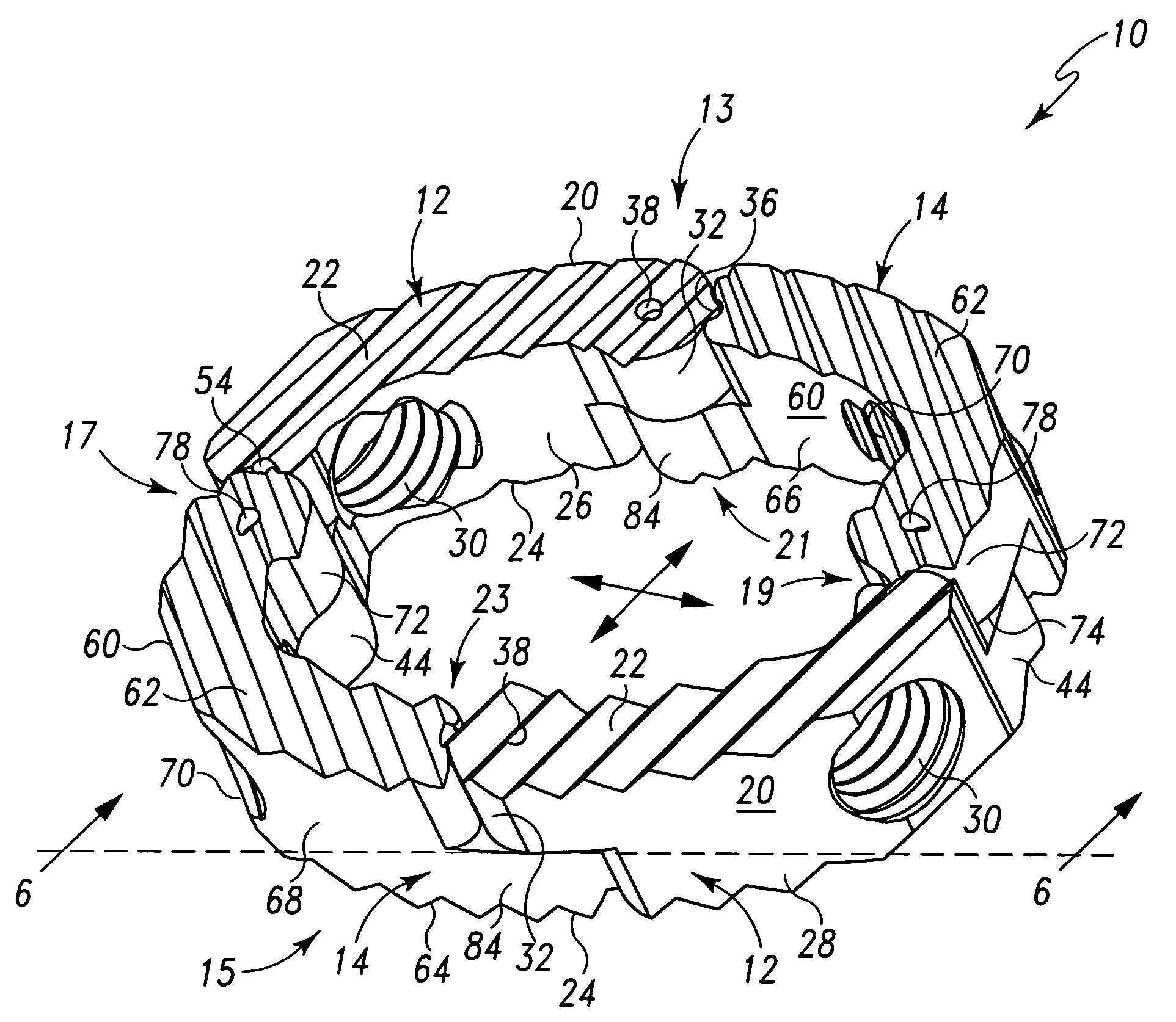 Radially expandable spinal interbody device and implantation tool