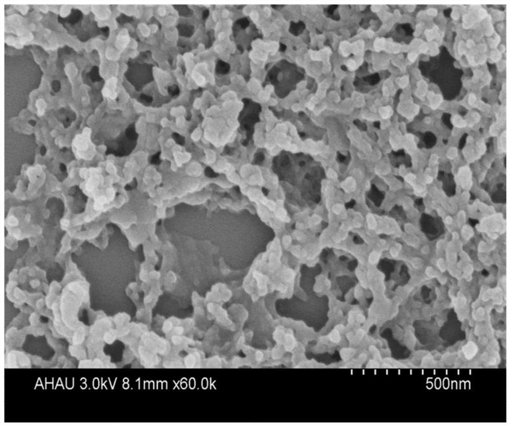 Sustained-release formulation of nano-zinc green tea coated with n-butyl cyanoacrylate and its application