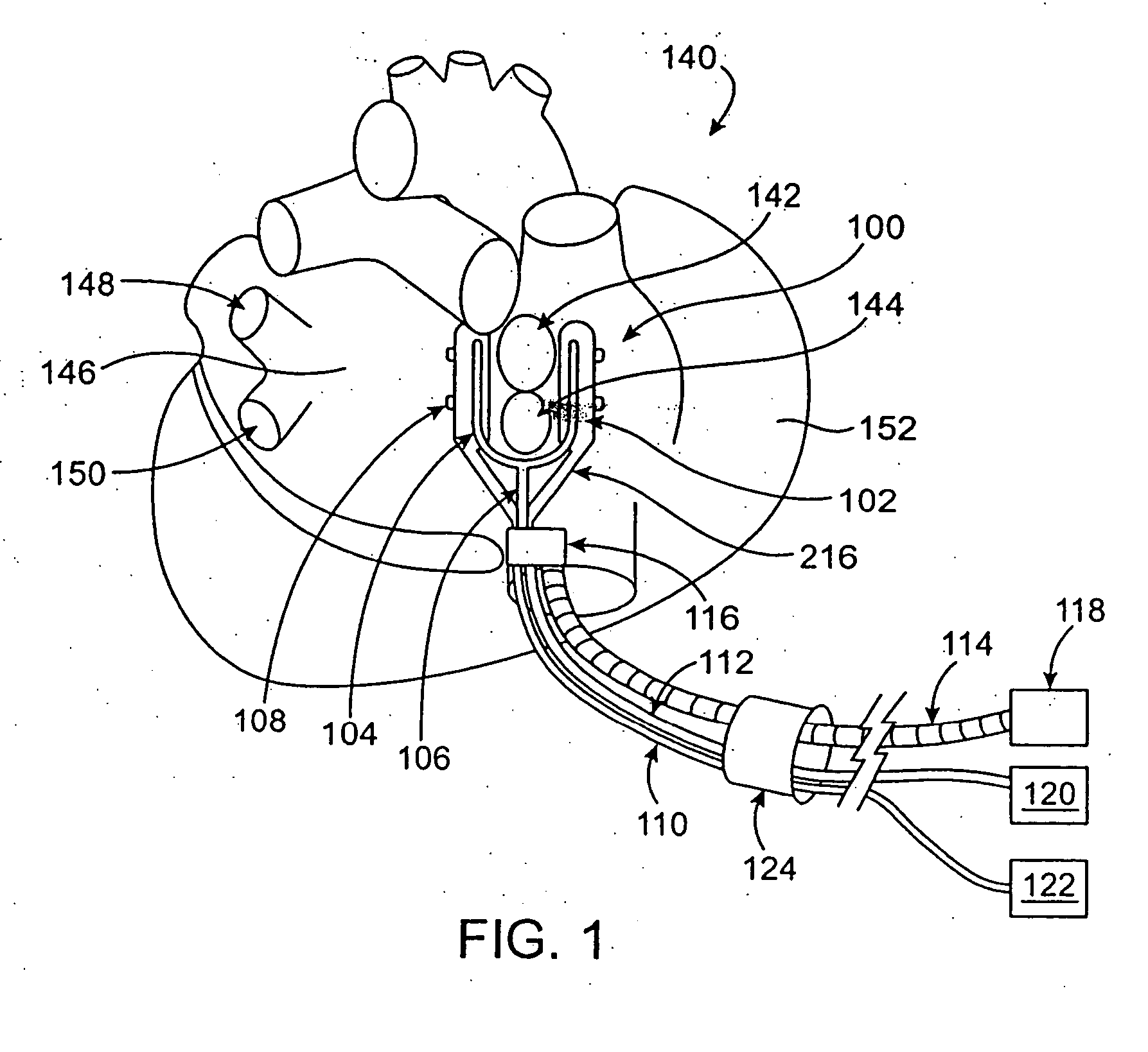 Cardiac ablation devices and methods