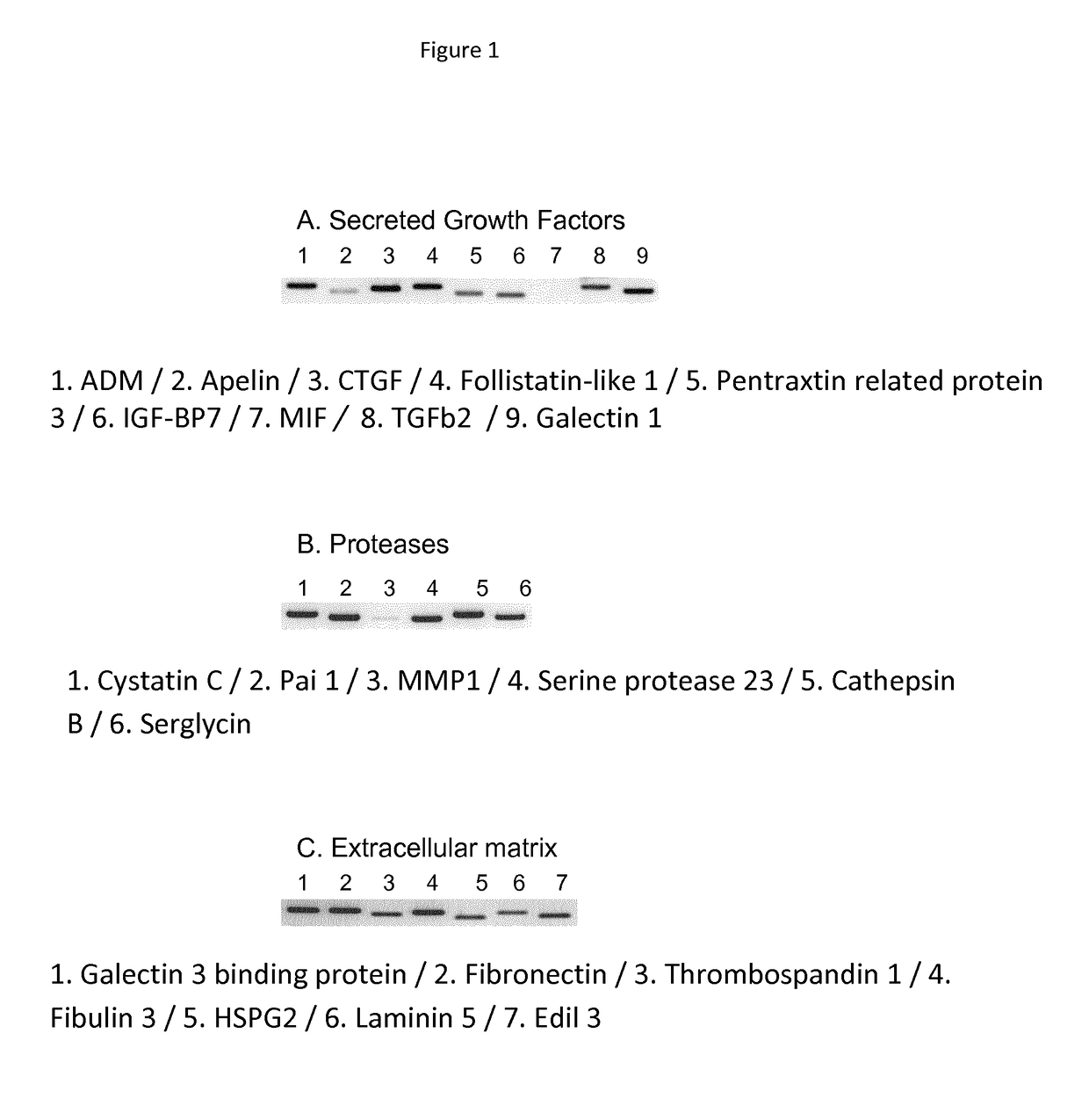 Use of compounds inhibiting apelin / apj / gp130 signaling for treating cancer