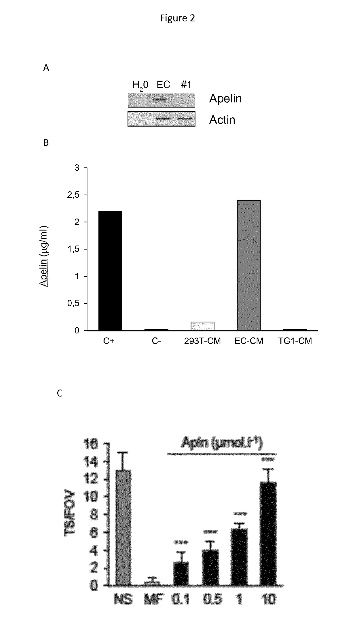 Use of compounds inhibiting apelin / apj / gp130 signaling for treating cancer