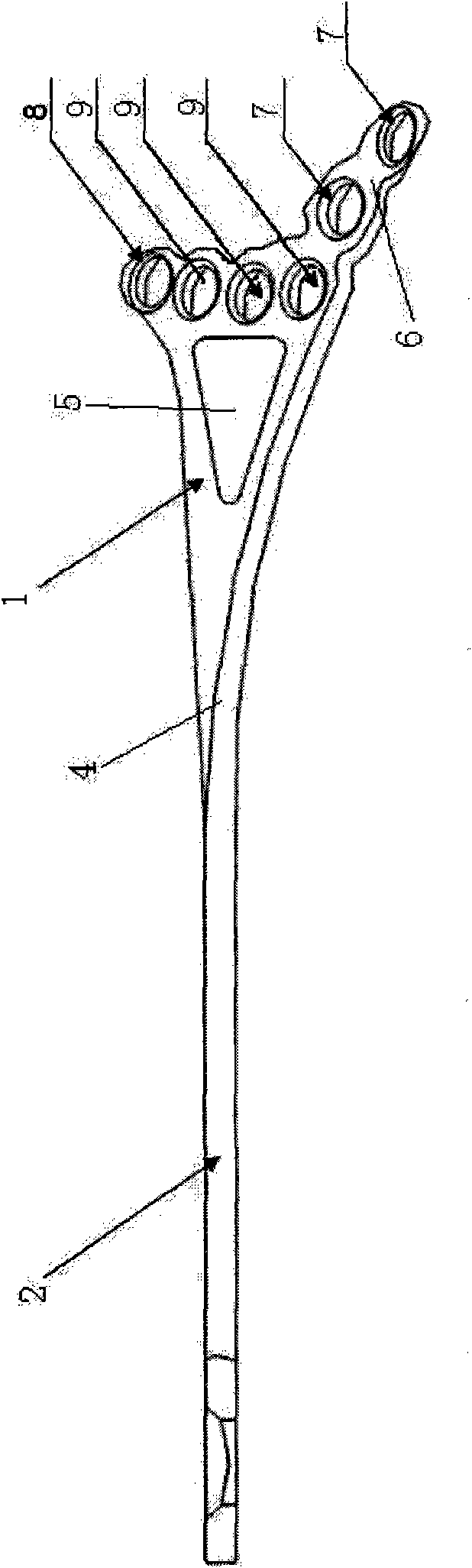 Distal tibial anterolateral anatomical bone plate