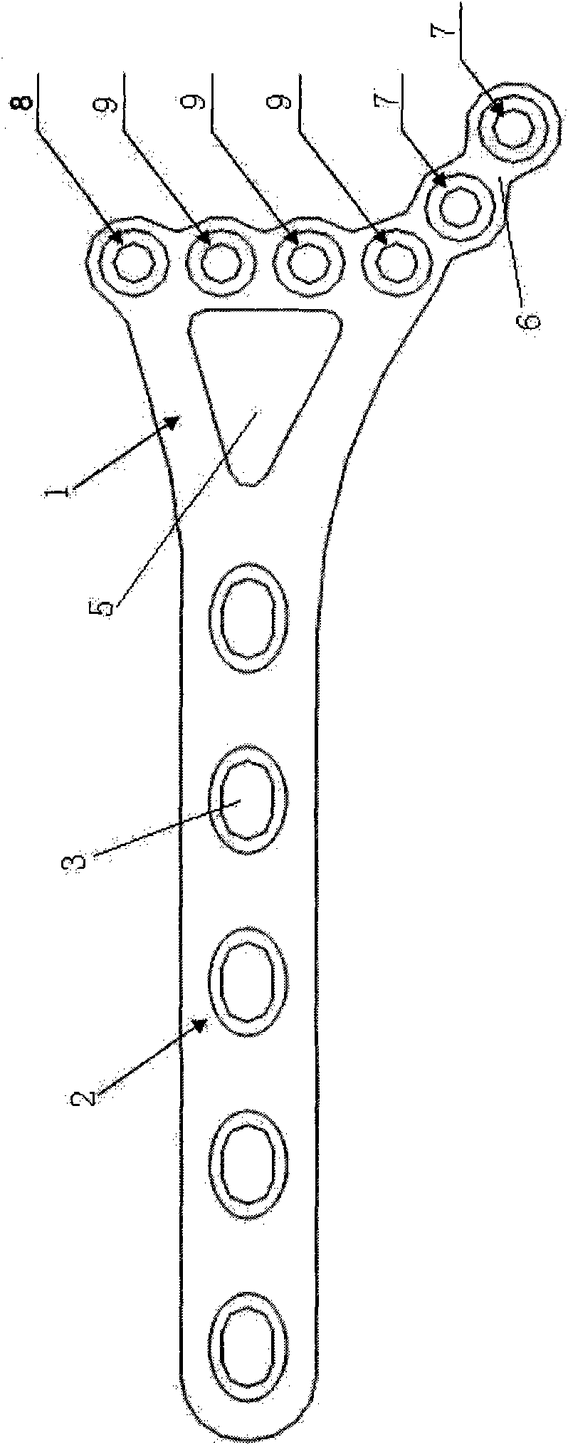 Distal tibial anterolateral anatomical bone plate