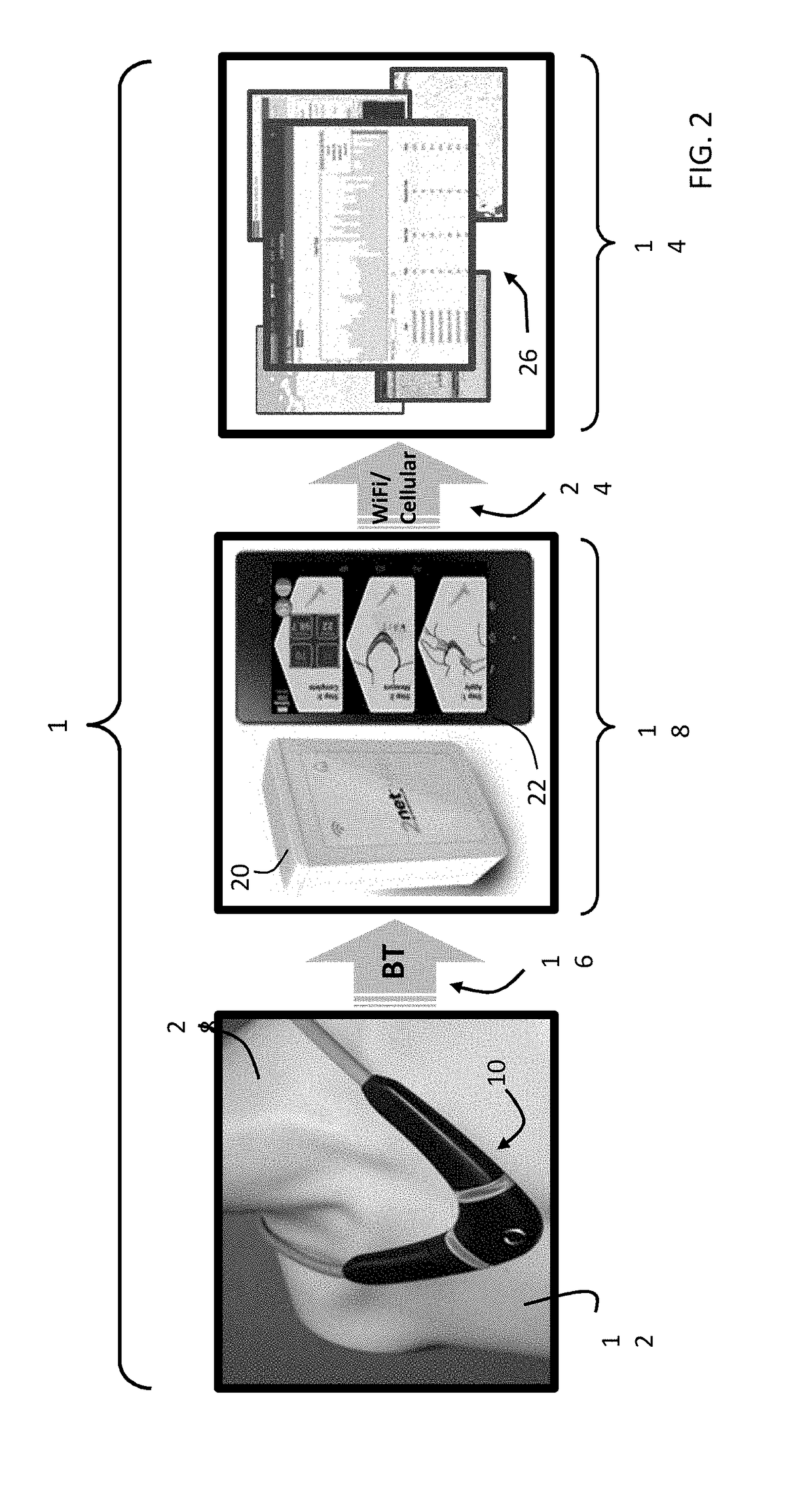 Neck-worn physiological monitor