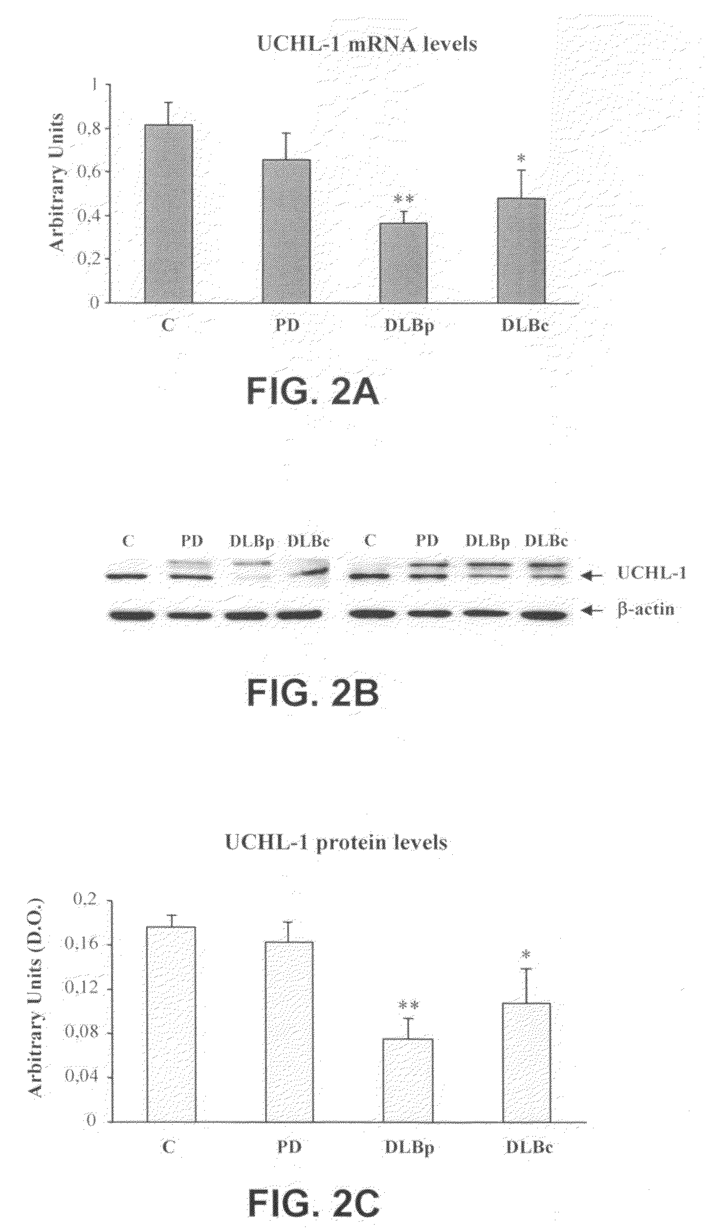 Molecular diagnostic method for dementia with lewy bodies