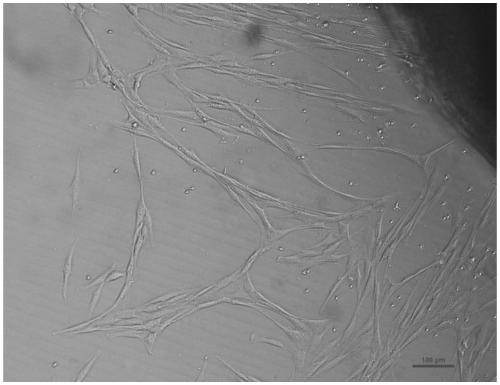 Dental pulp stem cell preparation method