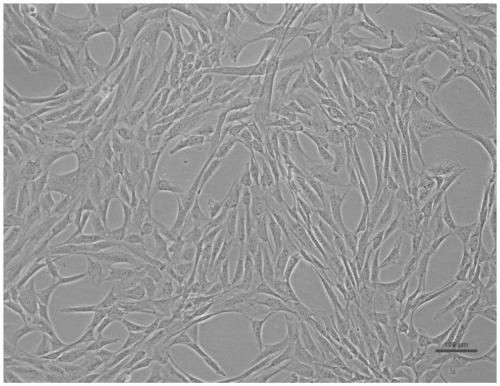 Dental pulp stem cell preparation method