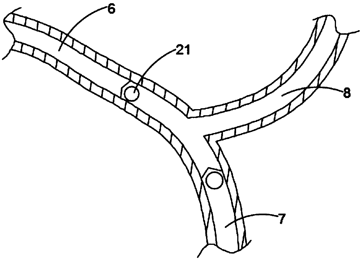 Pericardial effusion assisted drainage device