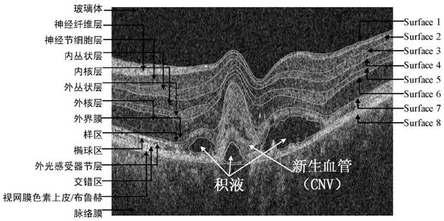 Layer Segmentation Method of Oct Image Based on Neural Network and Constrained Graph Search Algorithm