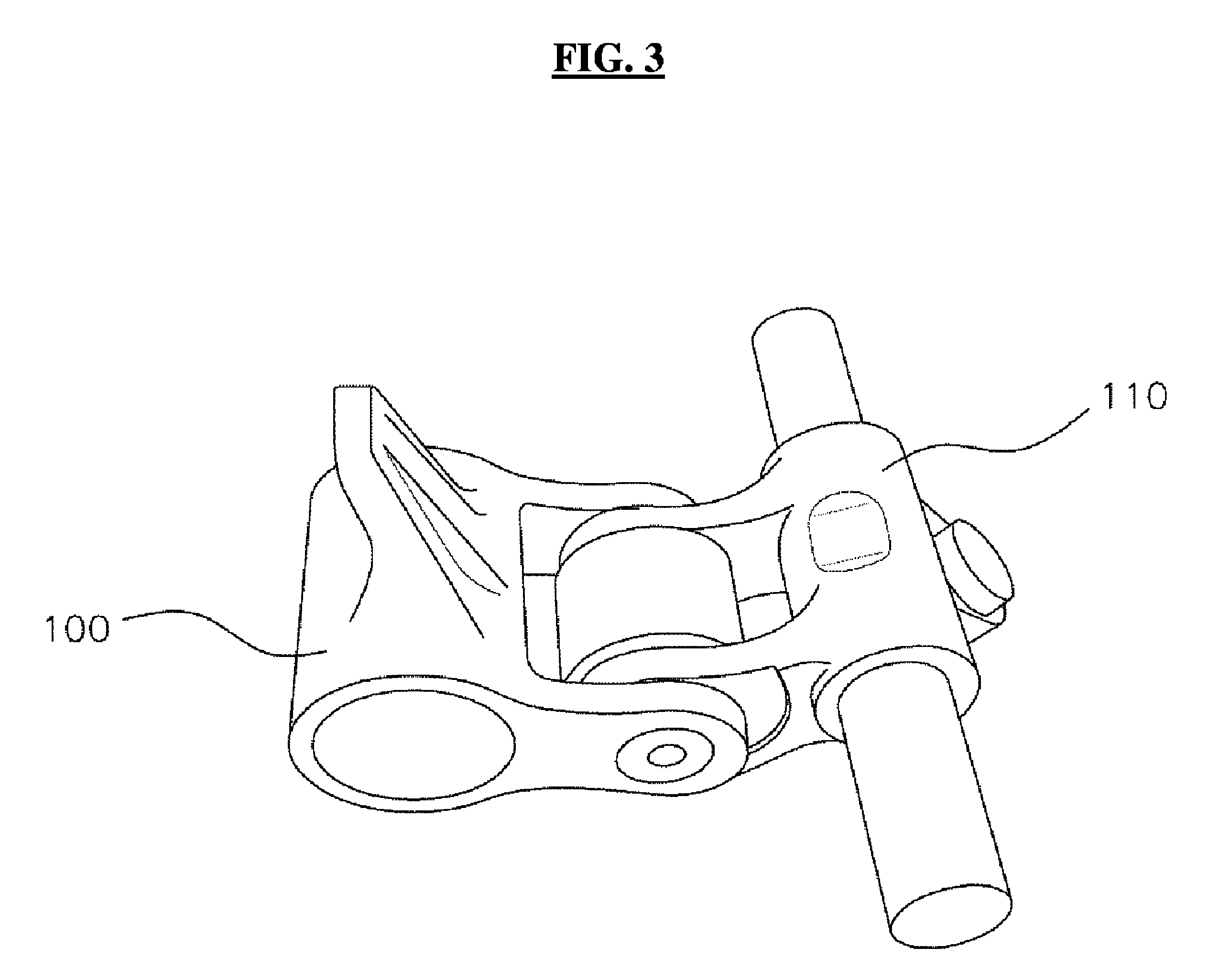 Method for manufacturing valve train parts using metal powder injection molding