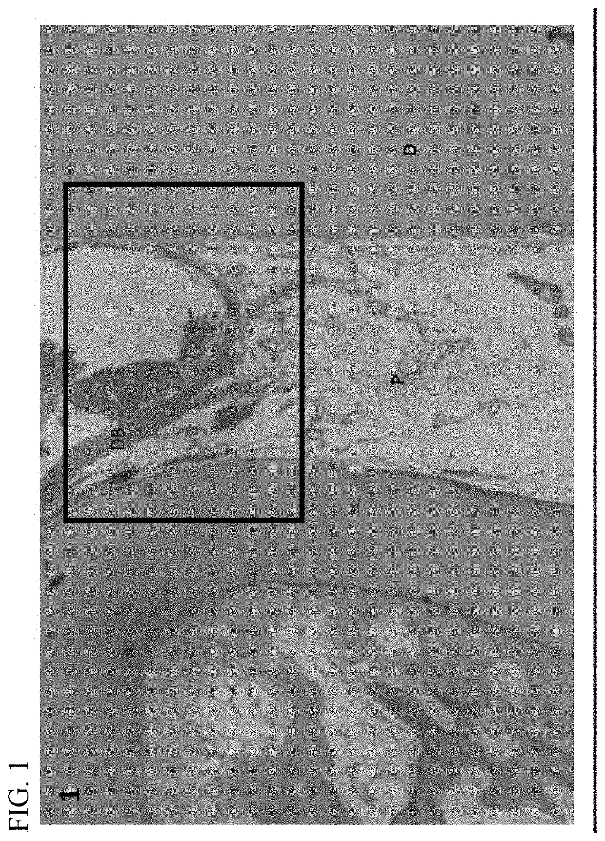 Dental pulp capping composition and method of preserving and regenerating capped pulp and dentin bridge