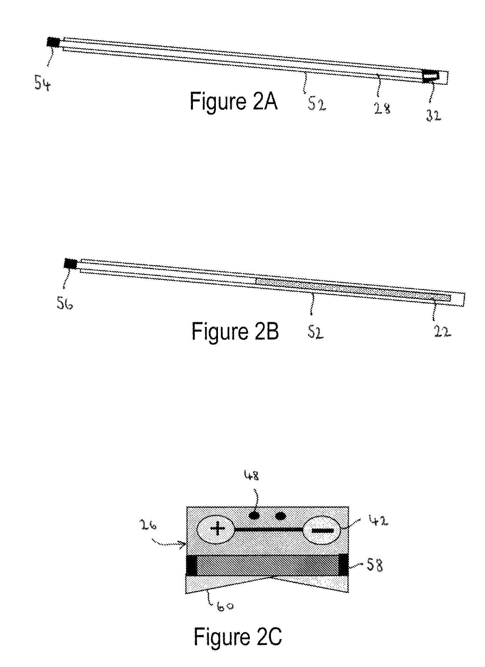 Implantable fluid management device for the removal of excess fluid