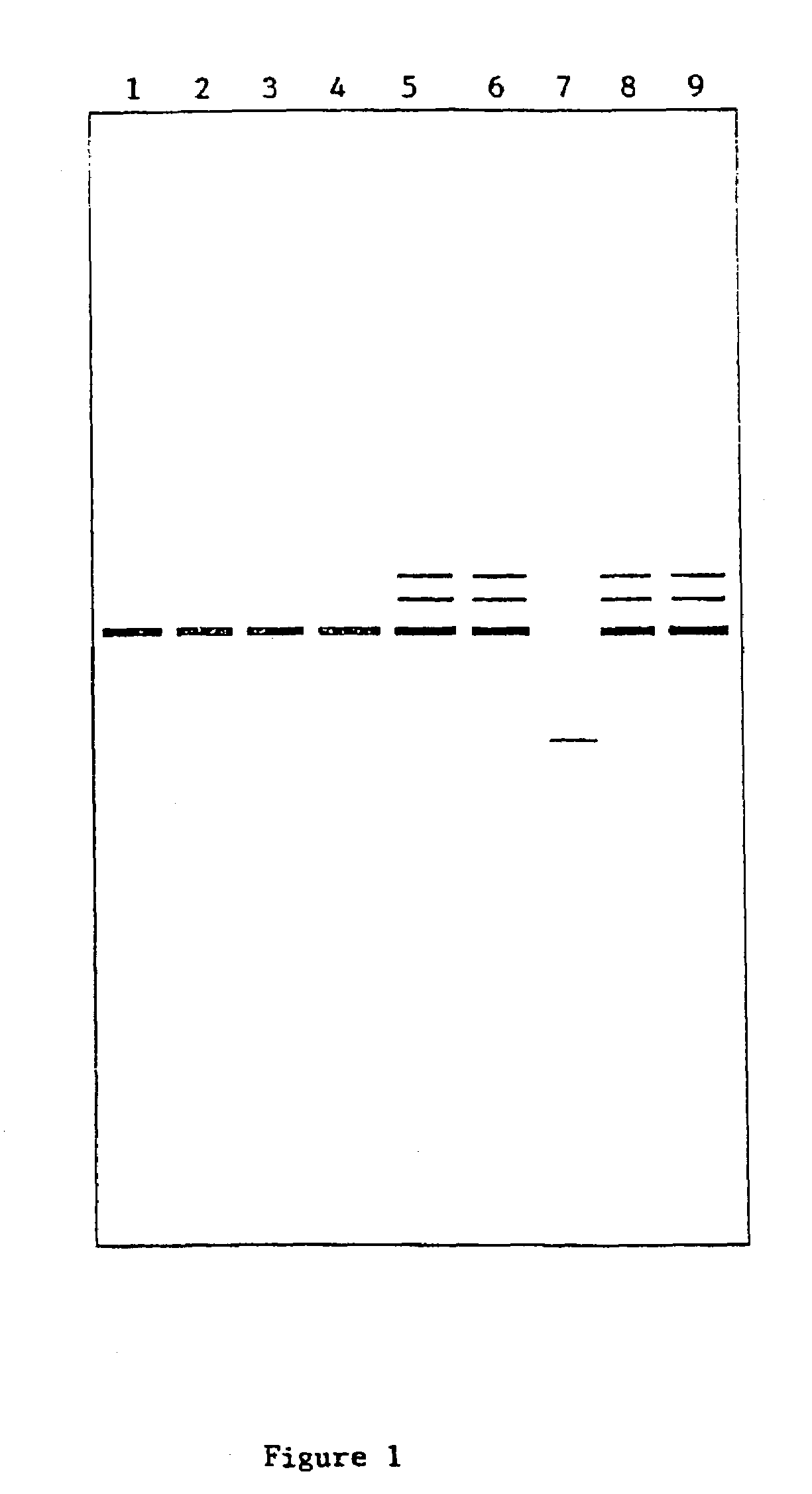 Mutation within the connexin 26 gene responsible for prelingual non-syndromic deafness and method of detection