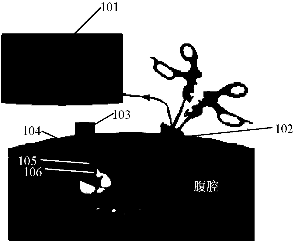 Peritoneoscope