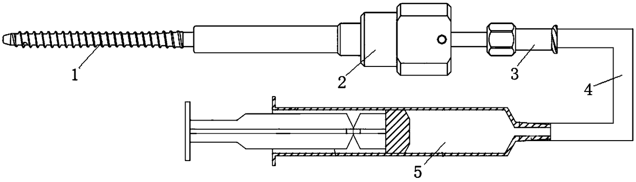 Acrylic cement fixation screw and acrylic cement injection device