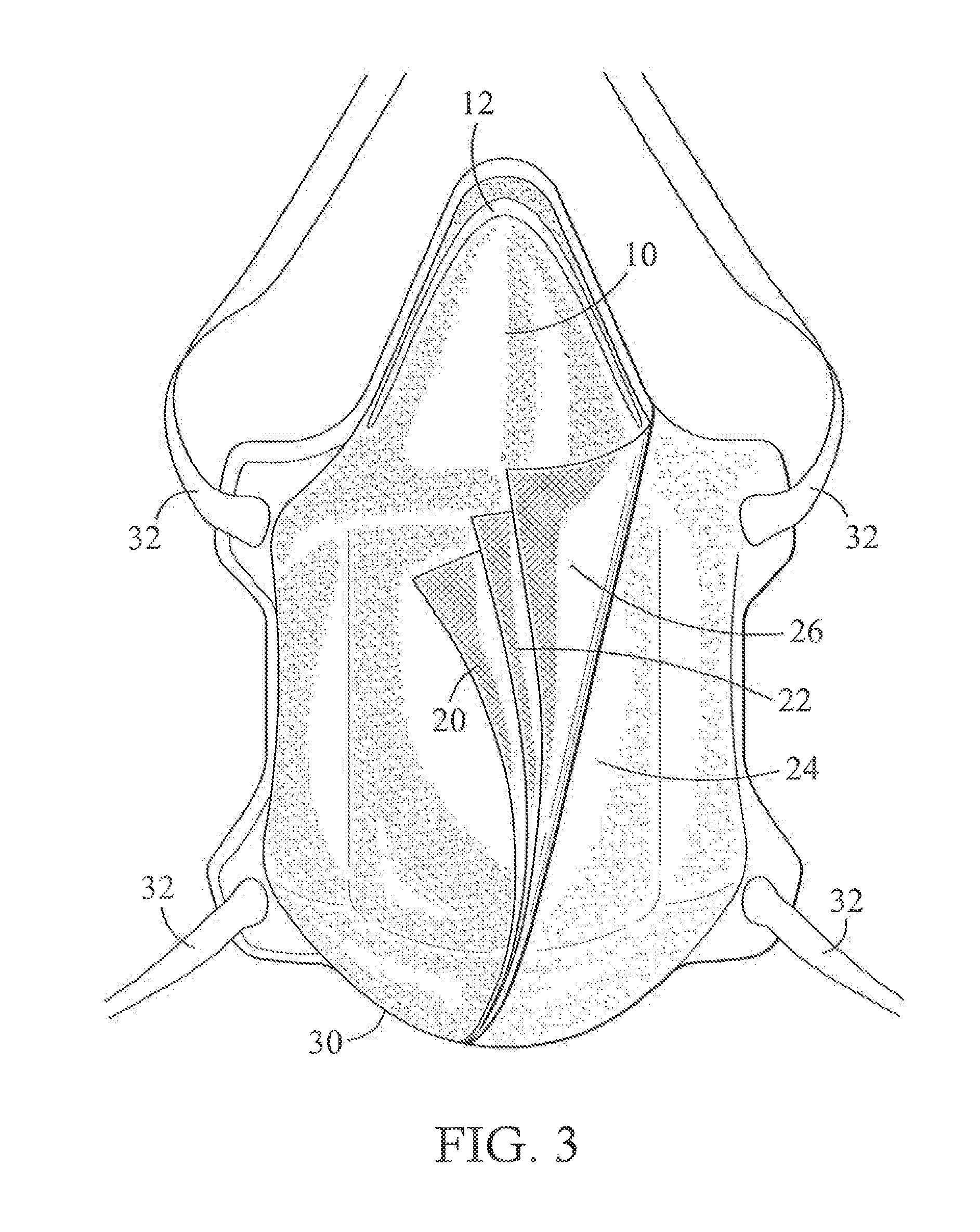 Self sanitizing face masks and method of manufacture