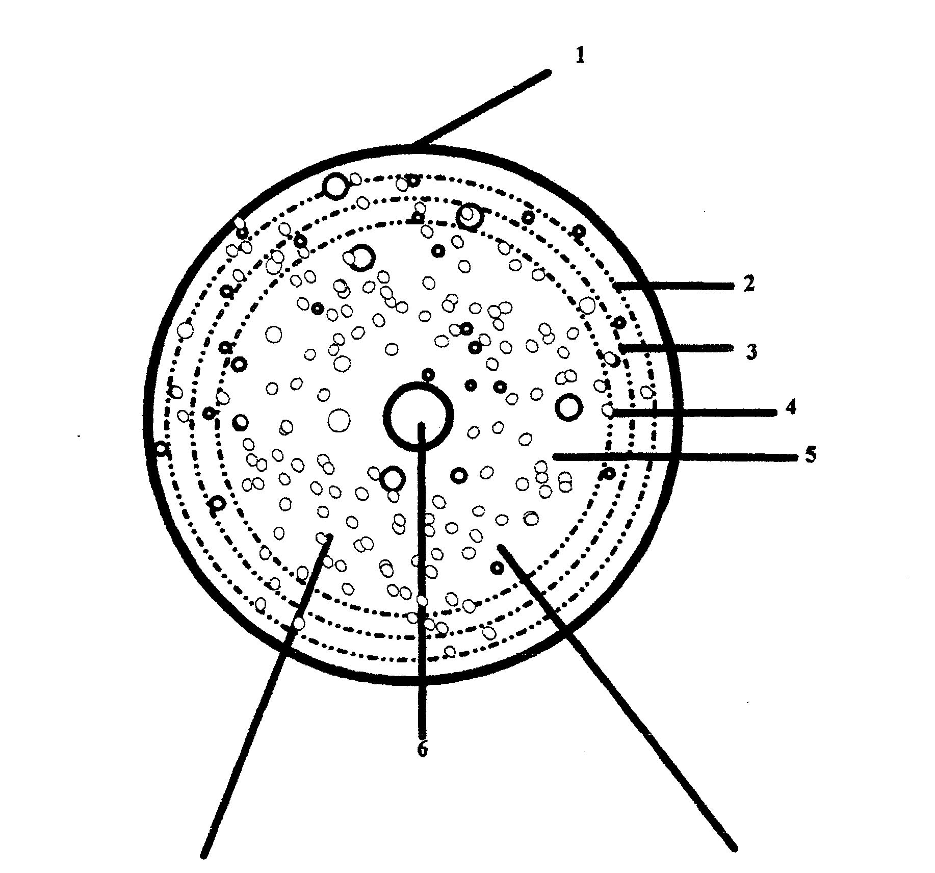 Adjustable areola and nipple prosethesis