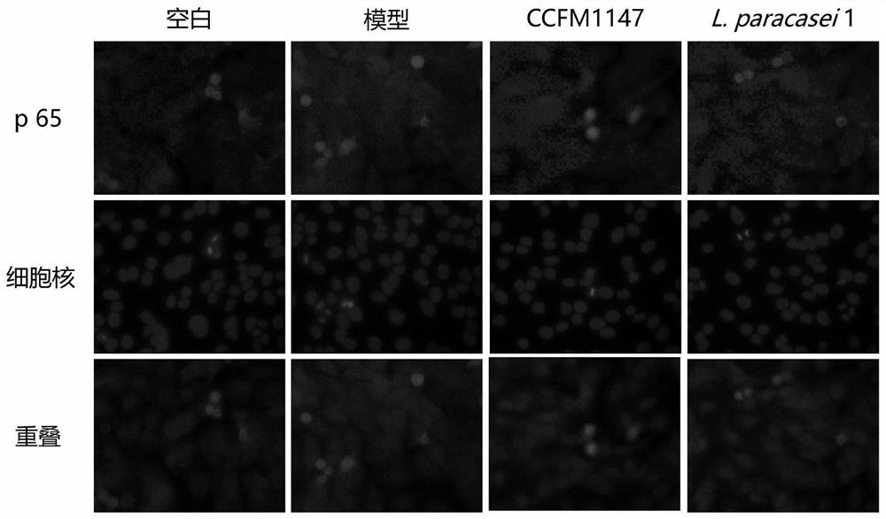 A strain of Lactobacillus paracasei that can inhibit the abnormal proliferation of hacat cells