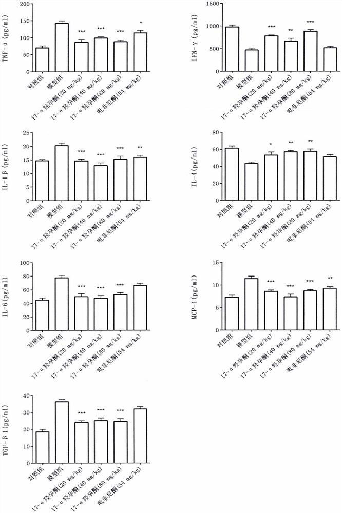 Application of hydroxyprogesterone hexanoate in preparation of medicine for treating interstitial pneumonia