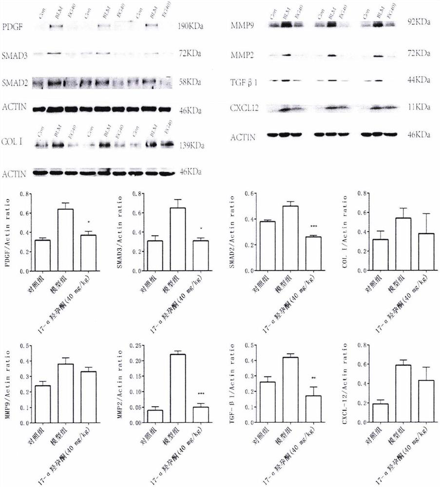 Application of hydroxyprogesterone hexanoate in preparation of medicine for treating interstitial pneumonia