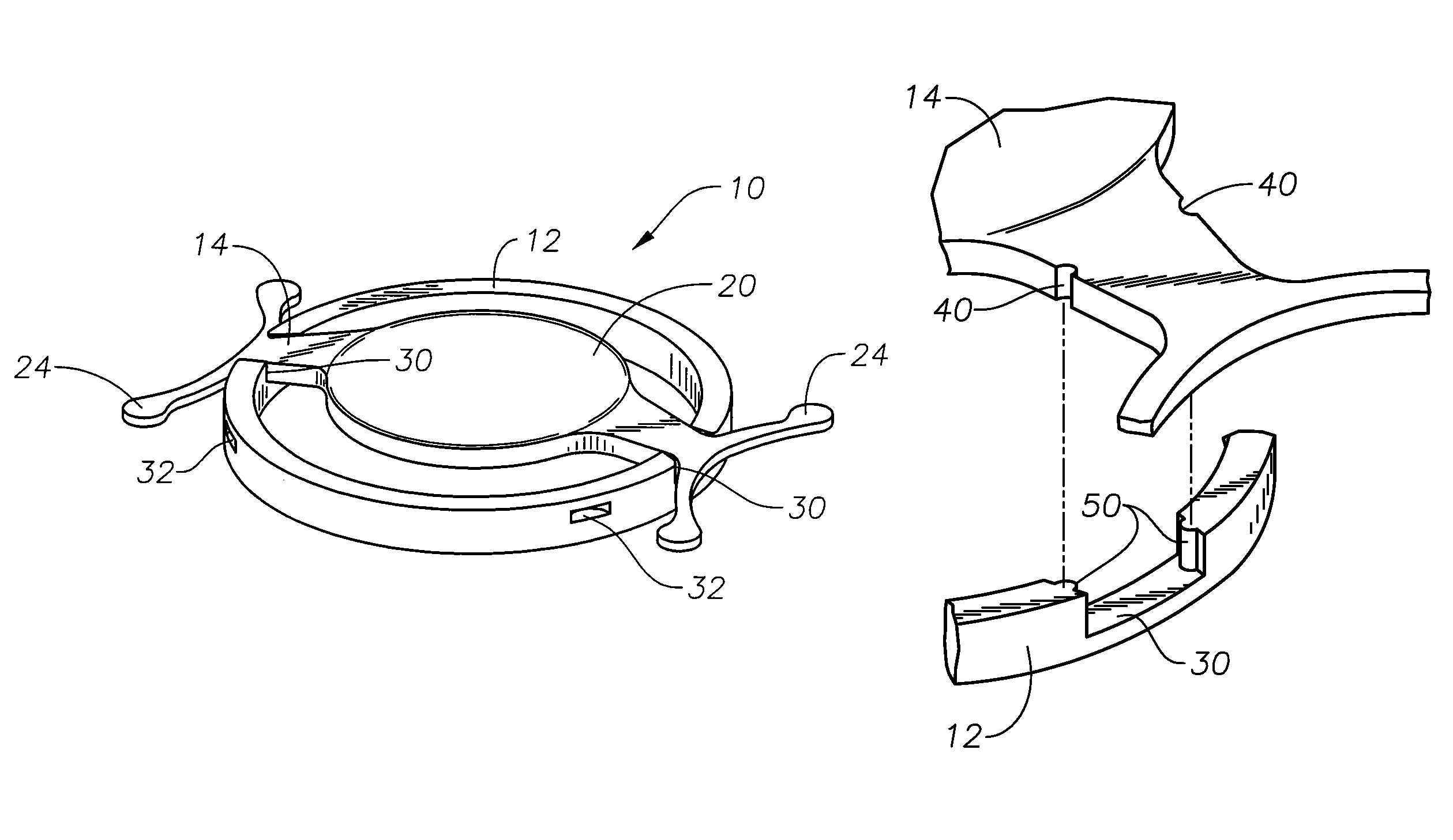 Single optic accommodative intraocular lens system