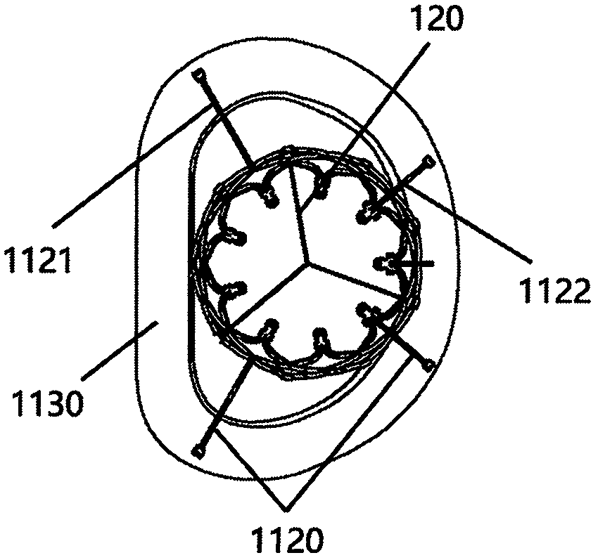 artificial valve prosthesis