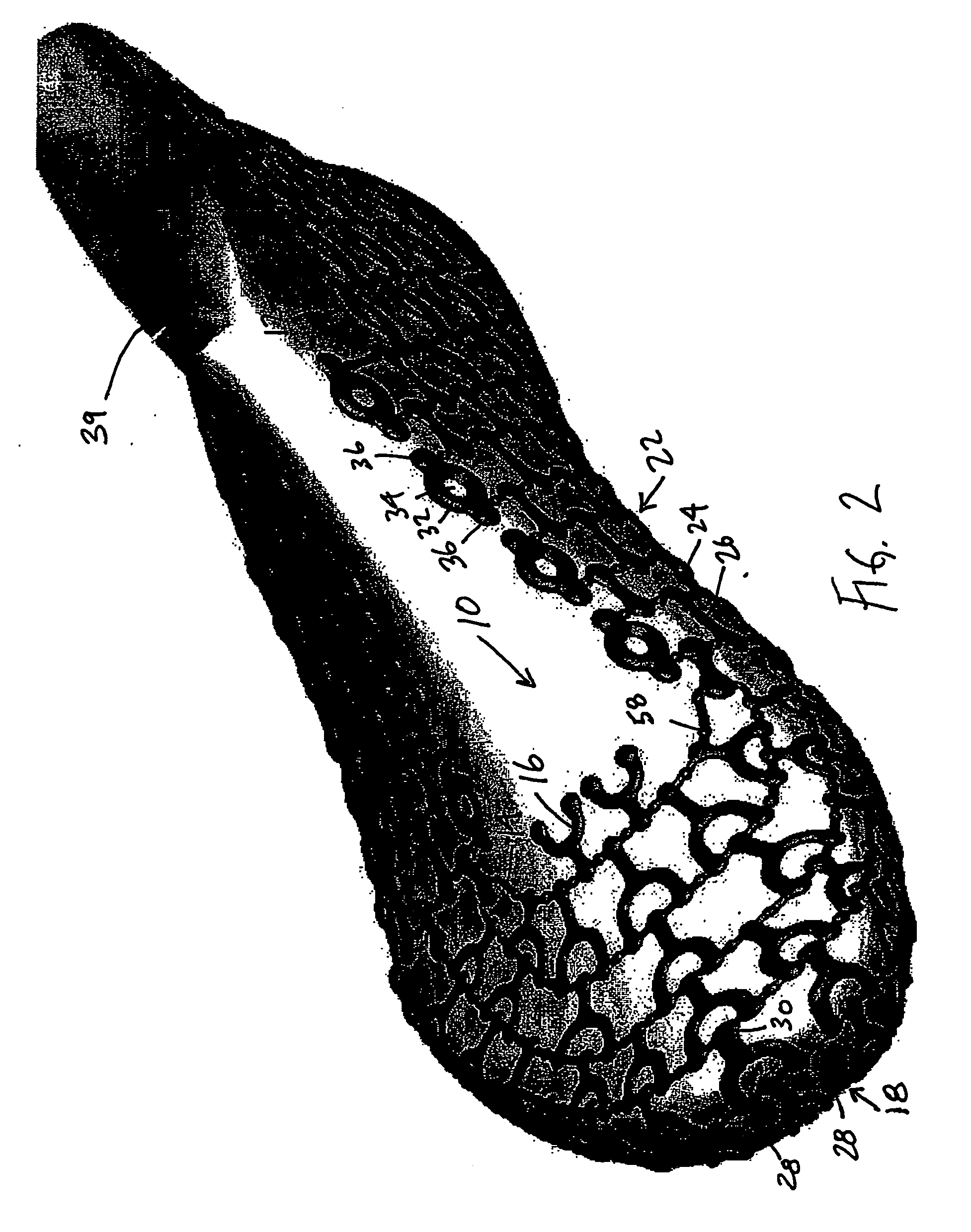 Material formed of multiple links and method of forming same