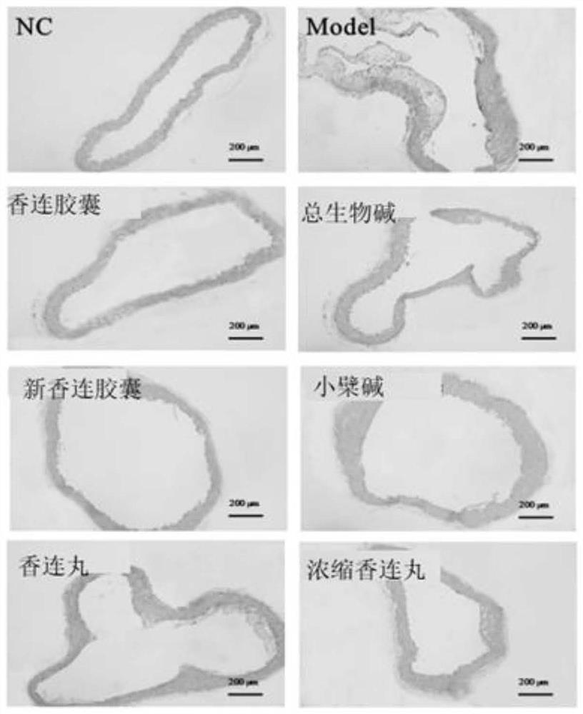 Novel application of Xianglian pill product