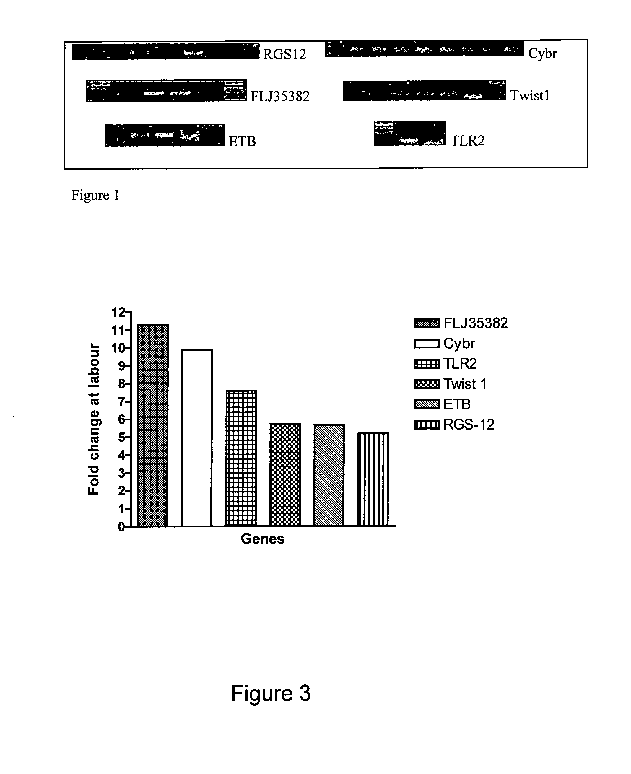 Marker Sequences for Labour