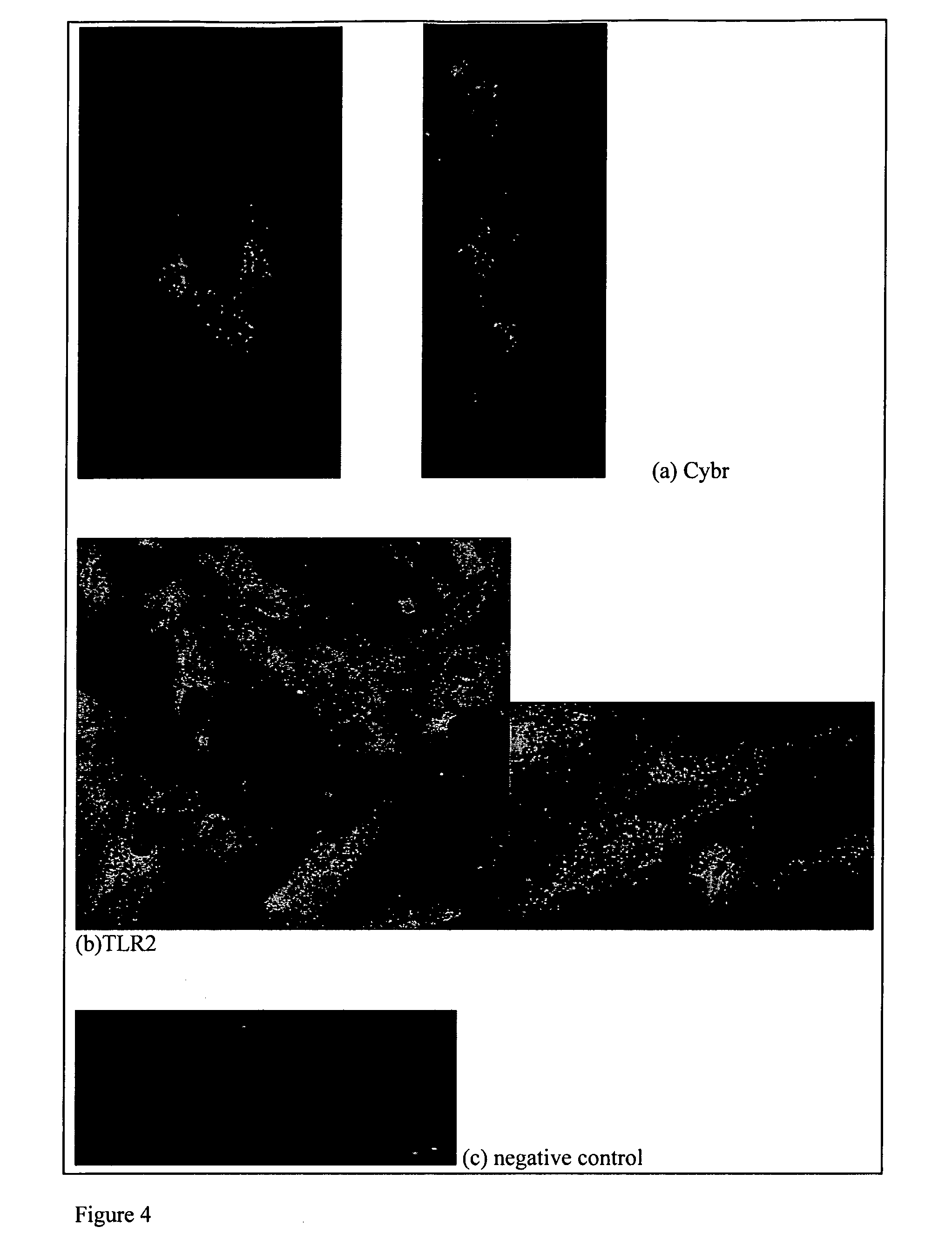 Marker Sequences for Labour