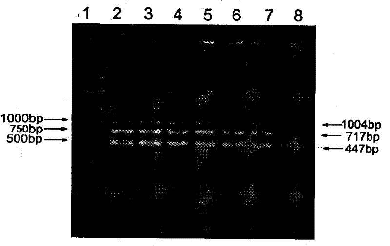 Method for detecting Francisella tularensis using multiple PCR technology