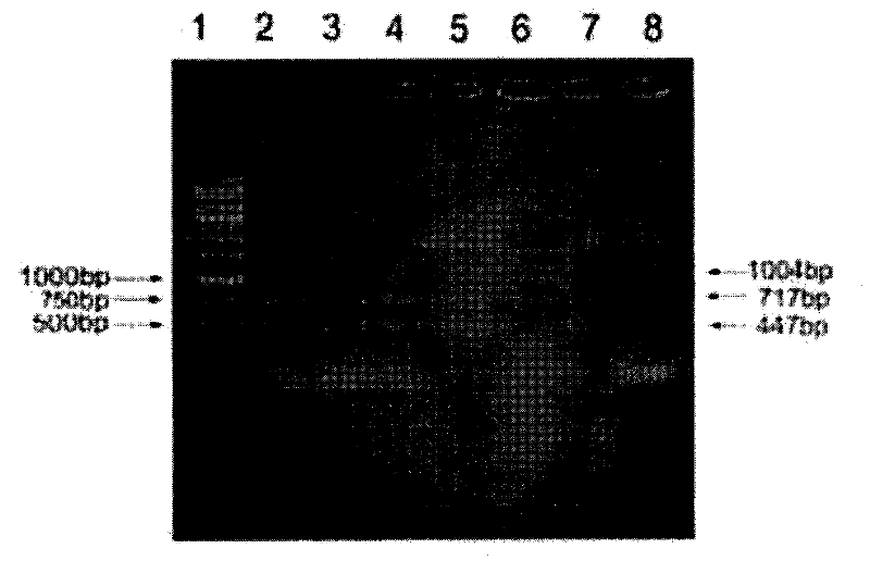 Method for detecting Francisella tularensis using multiple PCR technology