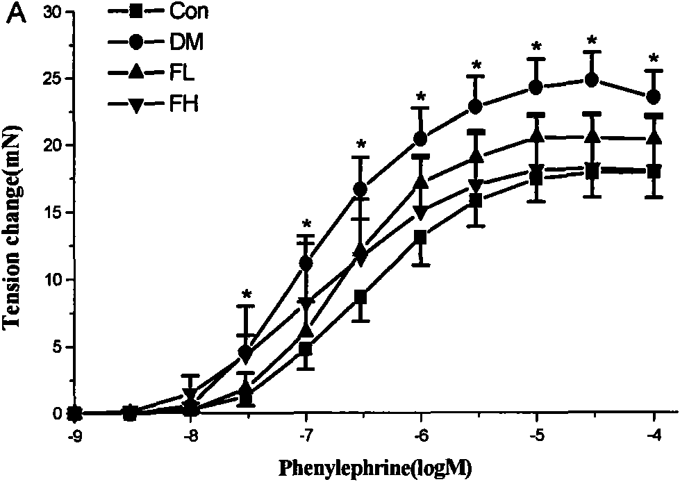 Application of alginate sulfuric ester in preparing drugs for preventing and treating diabetes and vascular diseases