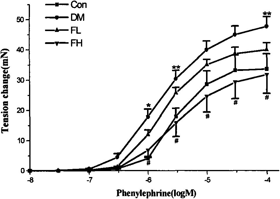 Application of alginate sulfuric ester in preparing drugs for preventing and treating diabetes and vascular diseases